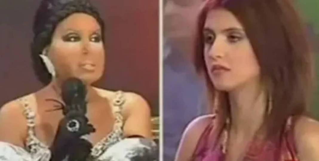 Acun, o ismi kovmuştu! Fırtına gibi döndü: Estetiği, Ajda Pekkan'ı solladı 4